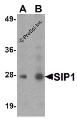 Western blot analysis of SIP1 in HeLa cell lysate with SIP1 antibody at (A) 0.5 and (B) 1μg/mL.