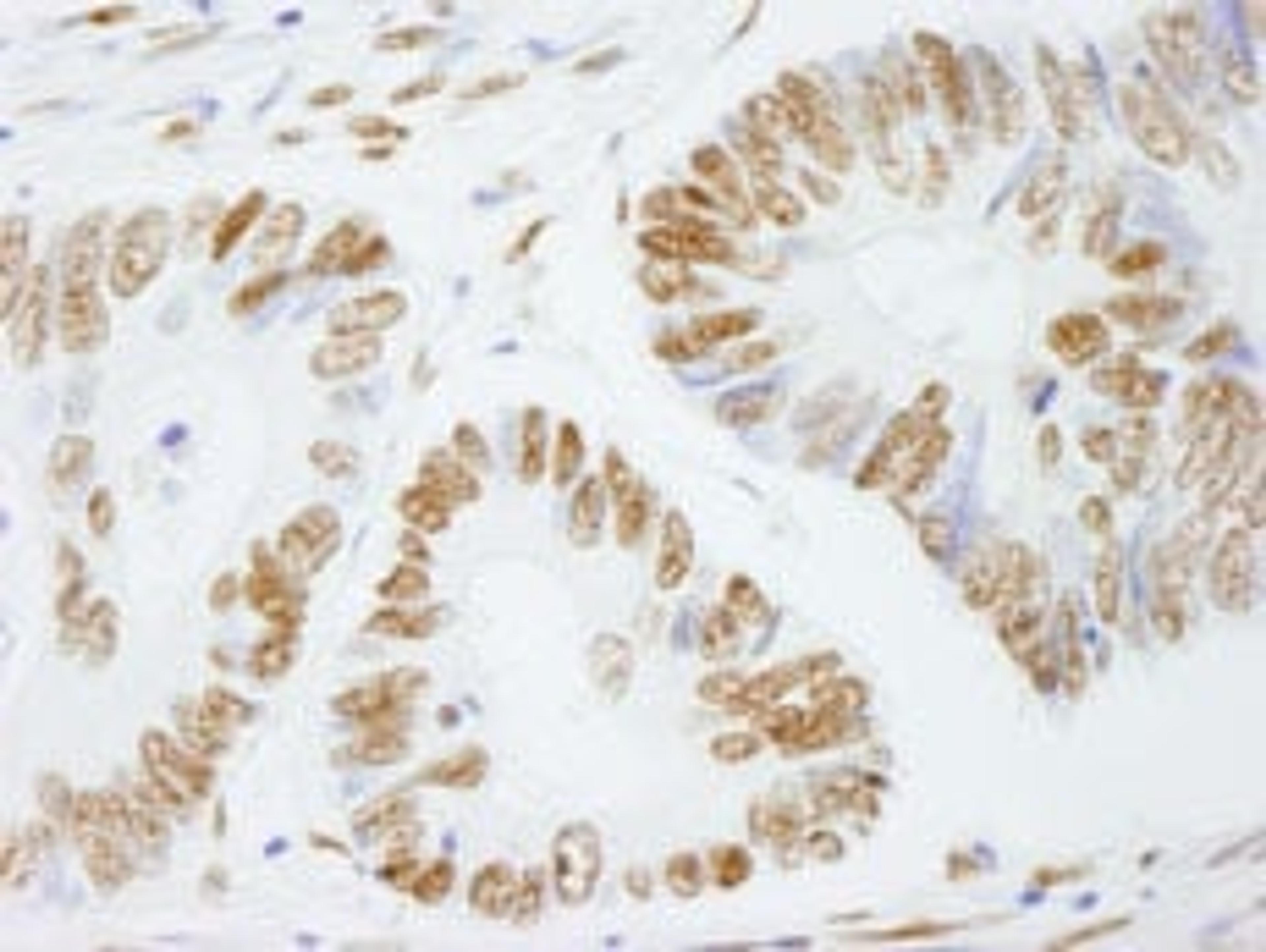 Detection of human PSF/SFPQ by immunohistochemistry.