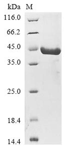 (Tris-Glycine gel) Discontinuous SDS-PAGE (reduced) with 5% enrichment gel and 15% separation gel.