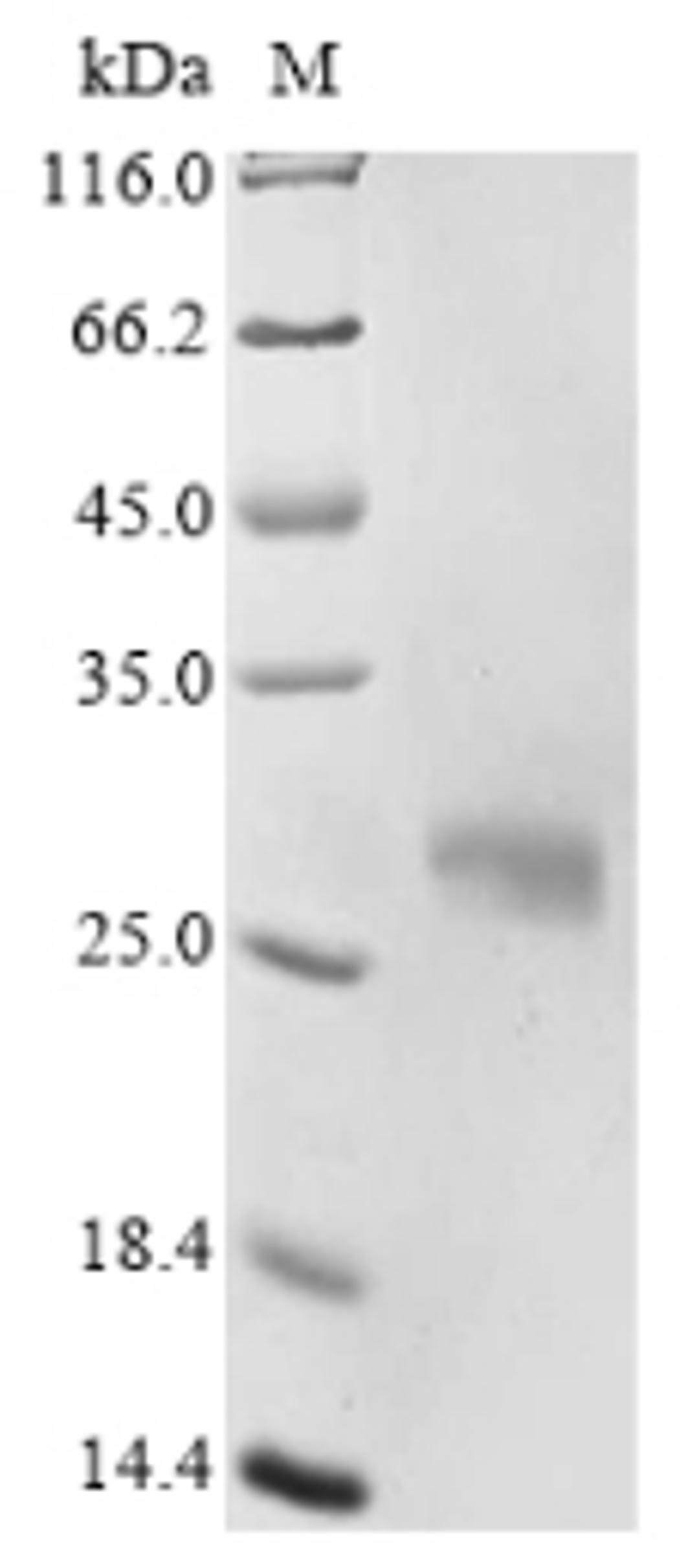 (Tris-Glycine gel) Discontinuous SDS-PAGE (reduced) with 5% enrichment gel and 15% separation gel.