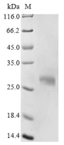 (Tris-Glycine gel) Discontinuous SDS-PAGE (reduced) with 5% enrichment gel and 15% separation gel.