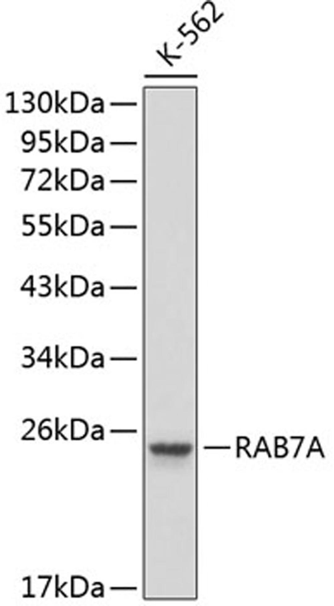 Western blot - RAB7A antibody (A1154)