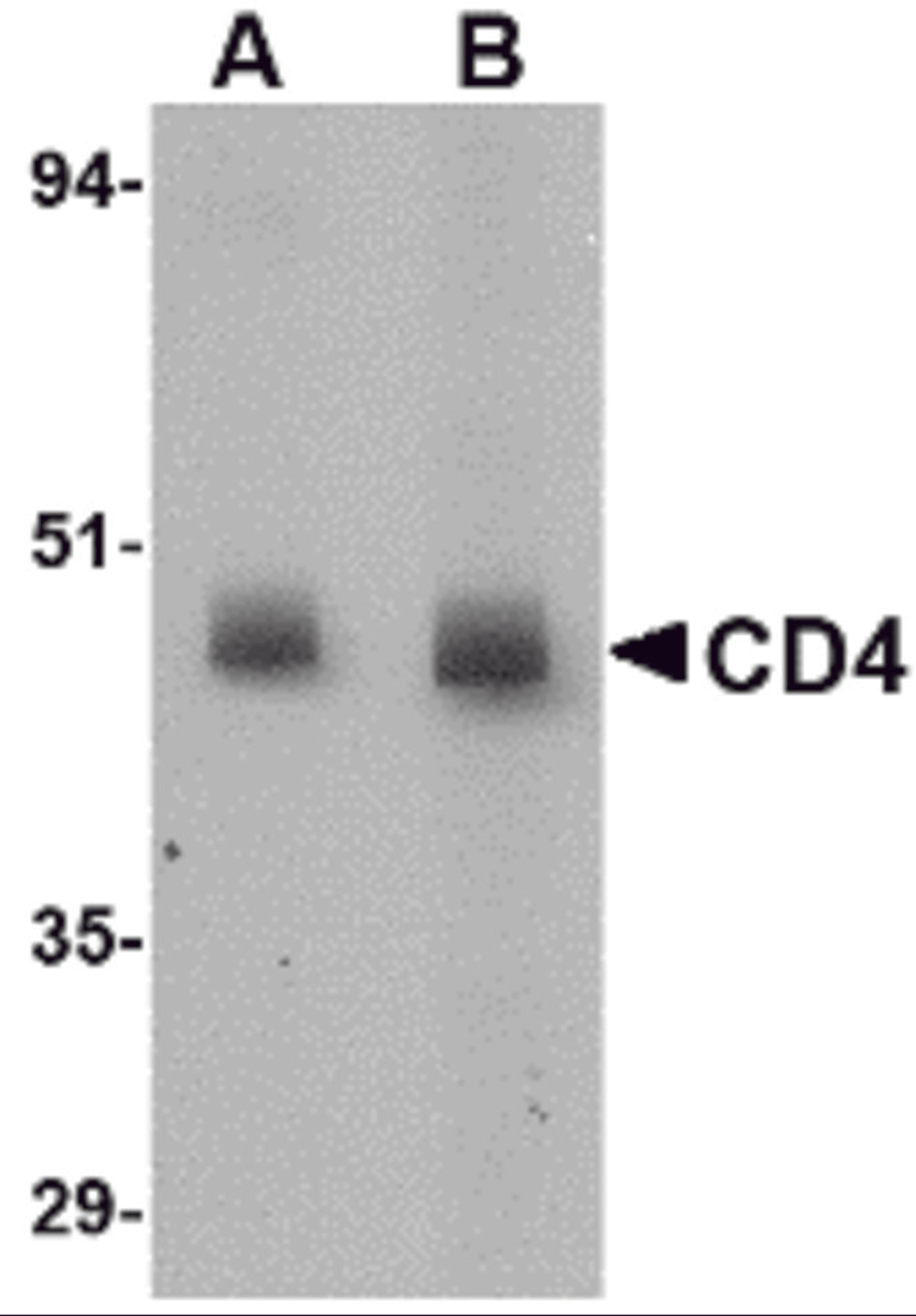 Western blot analysis of CD4 in rat lung tissue lysate with CD4 antibody at (A) 0.5 and (B) 1 &#956;g/mL.