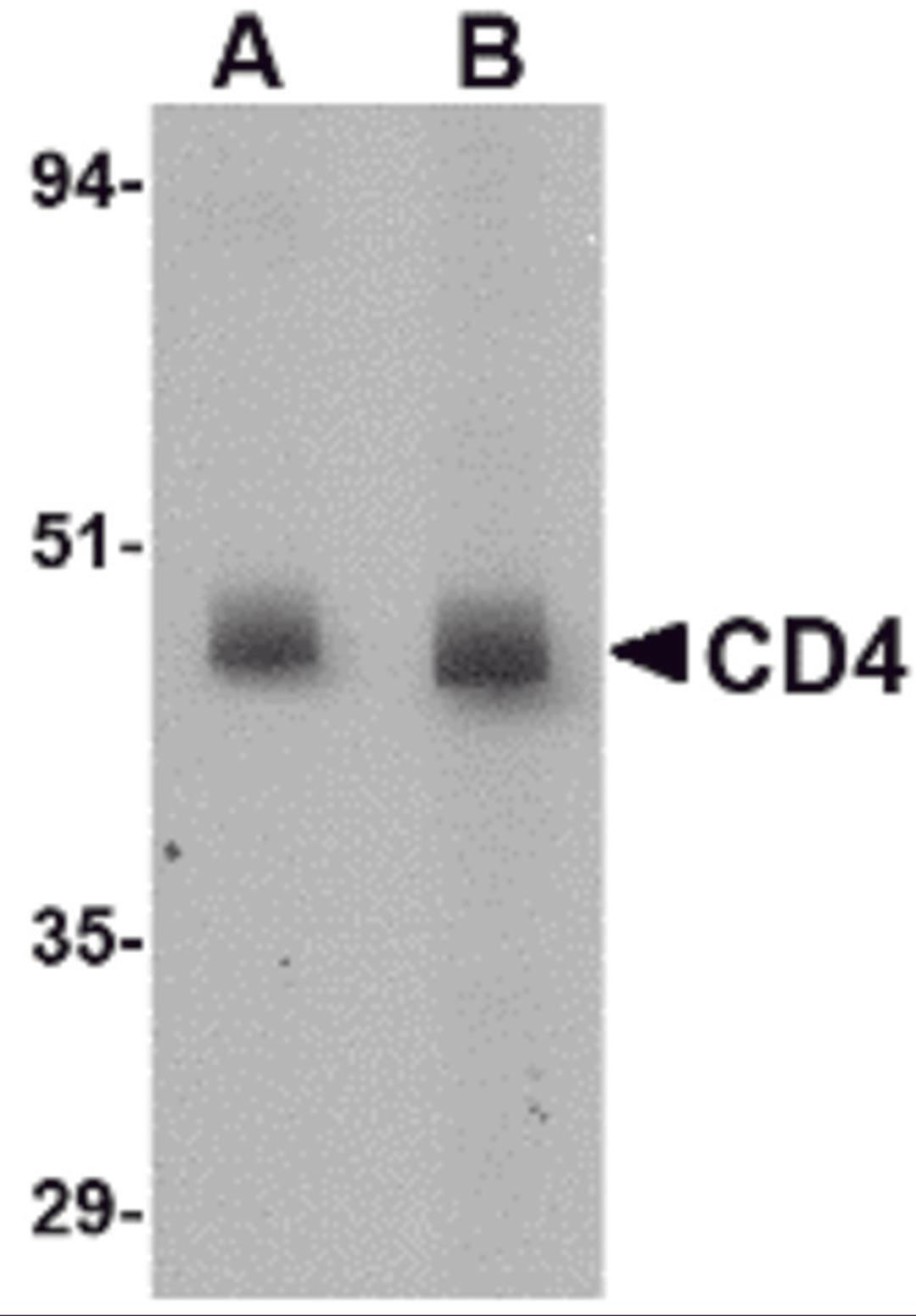Western blot analysis of CD4 in rat lung tissue lysate with CD4 antibody at (A) 0.5 and (B) 1 μg/mL.