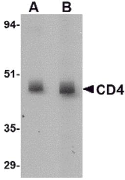 Western blot analysis of CD4 in rat lung tissue lysate with CD4 antibody at (A) 0.5 and (B) 1 μg/mL.