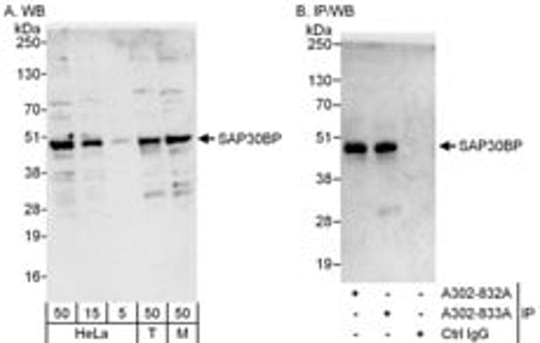 Detection of human and mouse SAP30BP by western blot (h&m) and immunoprecipitation (h).