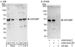 Detection of human and mouse SAP30BP by western blot (h&m) and immunoprecipitation (h).