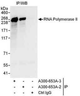 Detection of human RNA Polymerase II by western blot of immunoprecipitates.