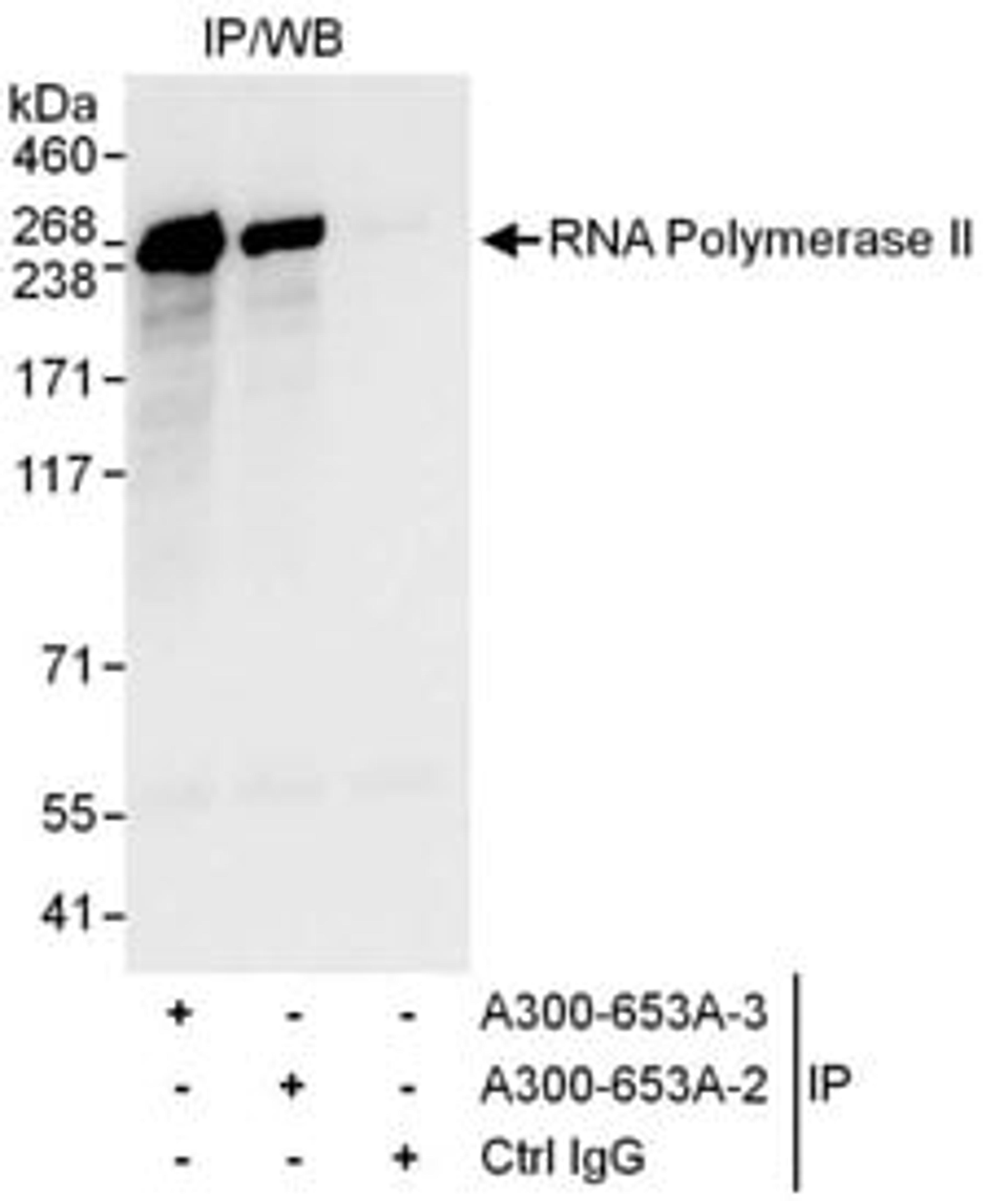 Detection of human RNA Polymerase II by western blot of immunoprecipitates.