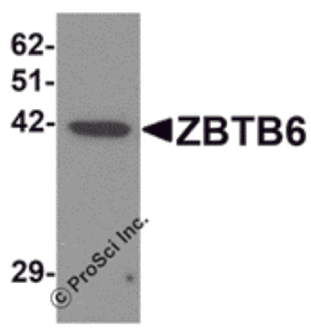 Western blot analysis of ZBTB6 in EL4 cell lysate with ZBTB6 antibody at 1 μg/mL.
