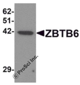Western blot analysis of ZBTB6 in EL4 cell lysate with ZBTB6 antibody at 1 μg/mL.