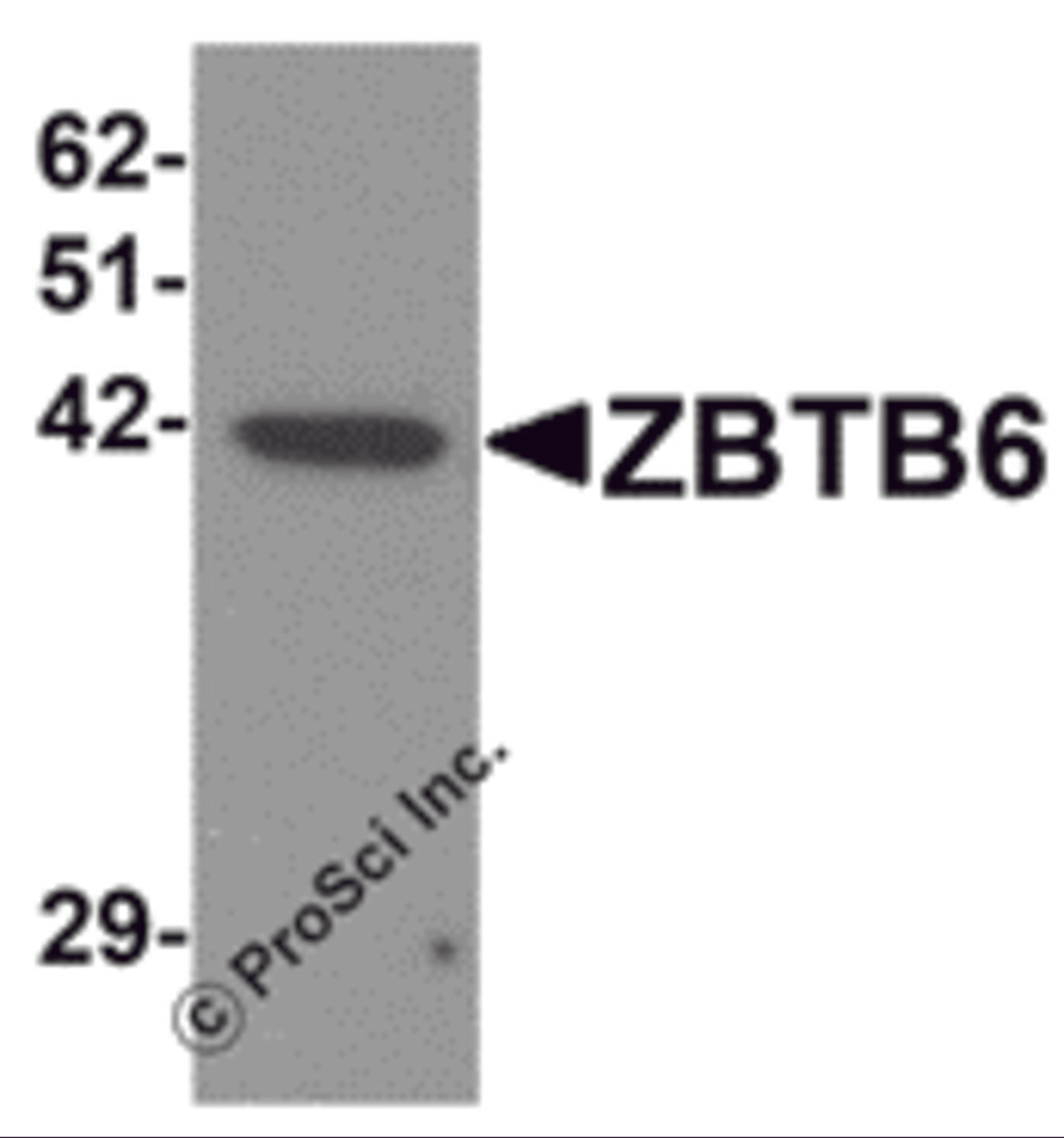 Western blot analysis of ZBTB6 in EL4 cell lysate with ZBTB6 antibody at 1 μg/mL.