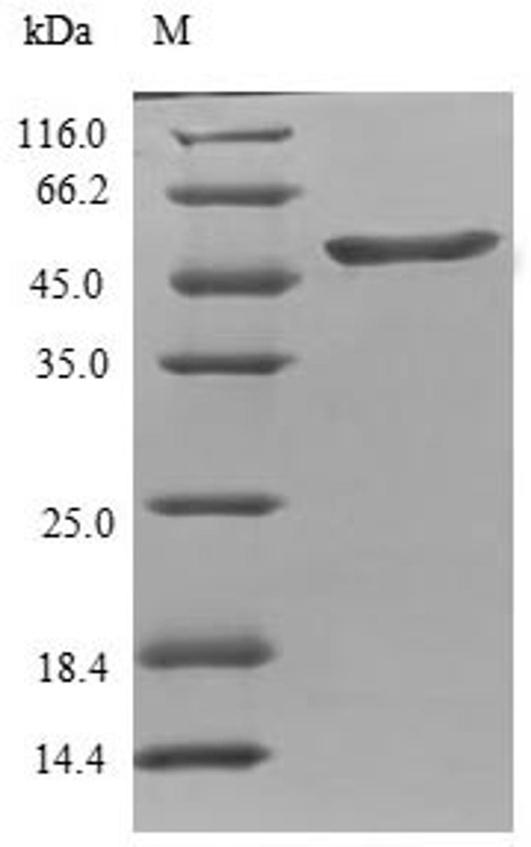 (Tris-Glycine gel) Discontinuous SDS-PAGE (reduced) with 5% enrichment gel and 15% separation gel.