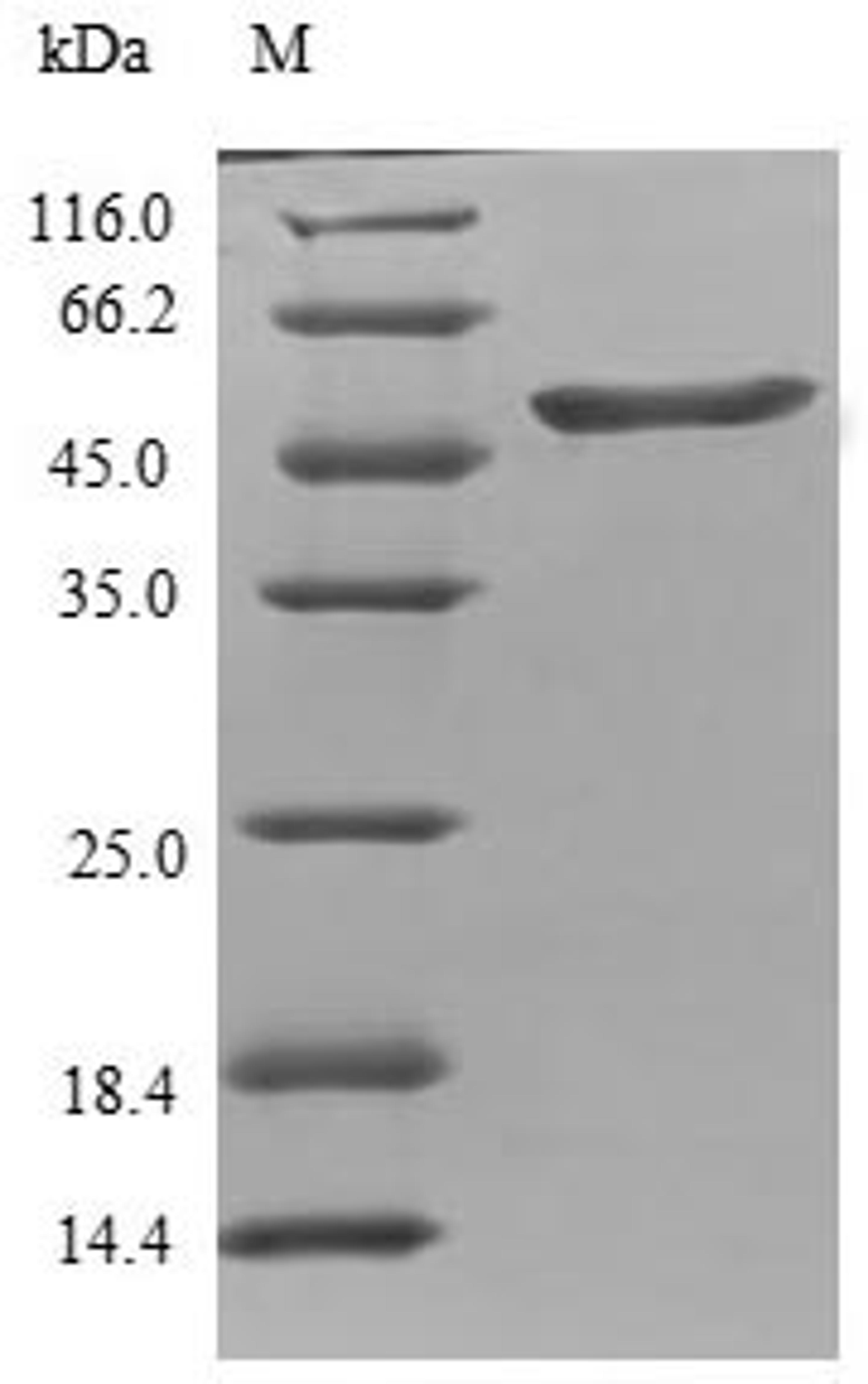 (Tris-Glycine gel) Discontinuous SDS-PAGE (reduced) with 5% enrichment gel and 15% separation gel.