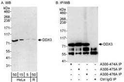 Detection of DDX3 by western blot and immunoprecipitation.