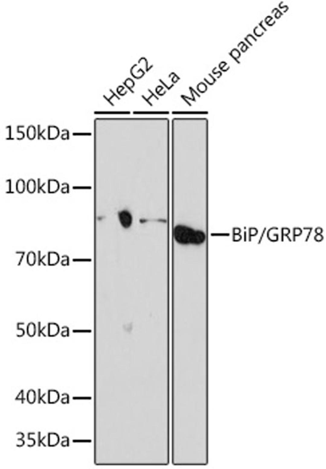 Western blot - BiP/GRP78 Rabbit mAb (A4908)