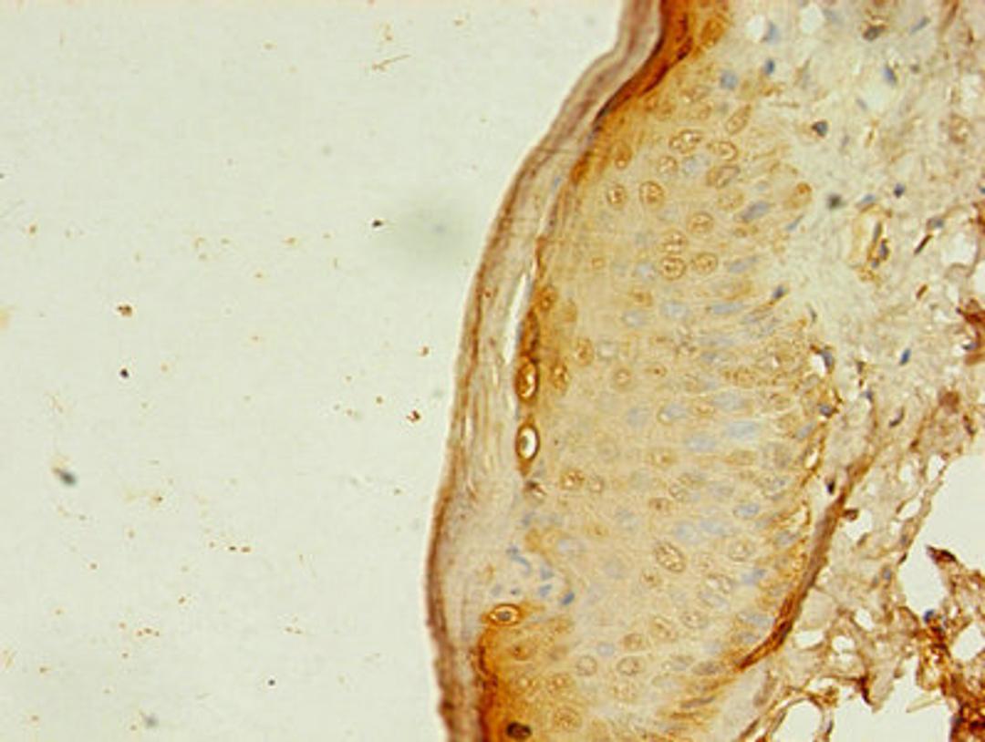 Immunohistochemistry of paraffin-embedded human skin tissue using CSB-PA001885LA01HU at dilution of 1:100