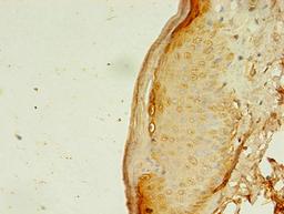Immunohistochemistry of paraffin-embedded human skin tissue using CSB-PA001885LA01HU at dilution of 1:100