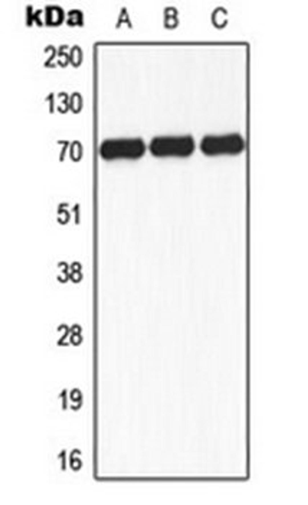 Western blot analysis of K562 insulin-treated (Lane 1), mouse brain (Lane 2), rat brain (Lane 3) whole cell lysates using S6K1 (phospho-S434) antibody