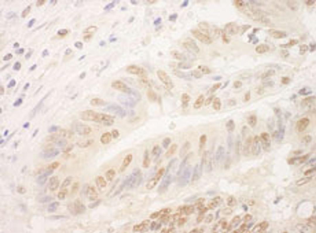 Detection of human NRIP by immunohistochemistry.