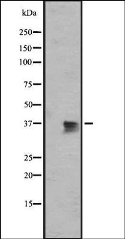 Western blot analysis of MDA-MB453 cell line lysate using OR1J2/1N2 antibody