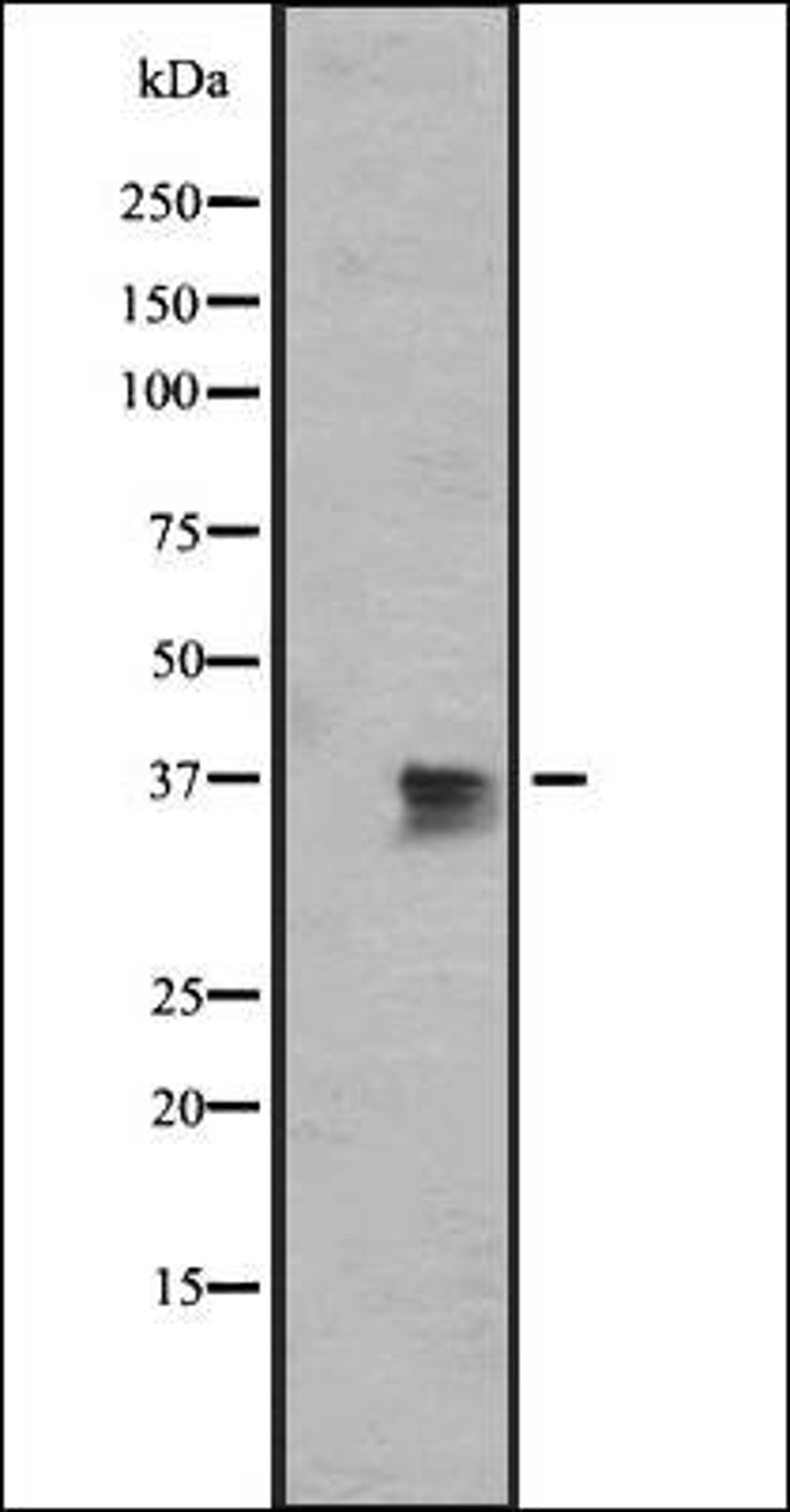 Western blot analysis of MDA-MB453 cell line lysate using OR1J2/1N2 antibody