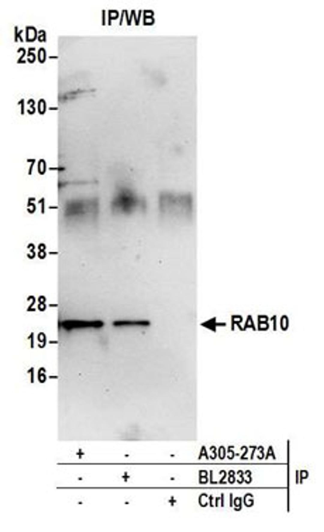 Detection of human RAB10 by western blot of immunoprecipitates.