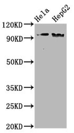 Western Blot. Positive WB detected in Hela whole cell lysate,HepG2 whole cell lysate. All lanes Phospho-NBN antibody at 1.98μg/ml. Secondary. Goat polyclonal to rabbit IgG at 1/50000 dilution. Predicted band size: 95 KDa. Observed band size: 95 KDa.