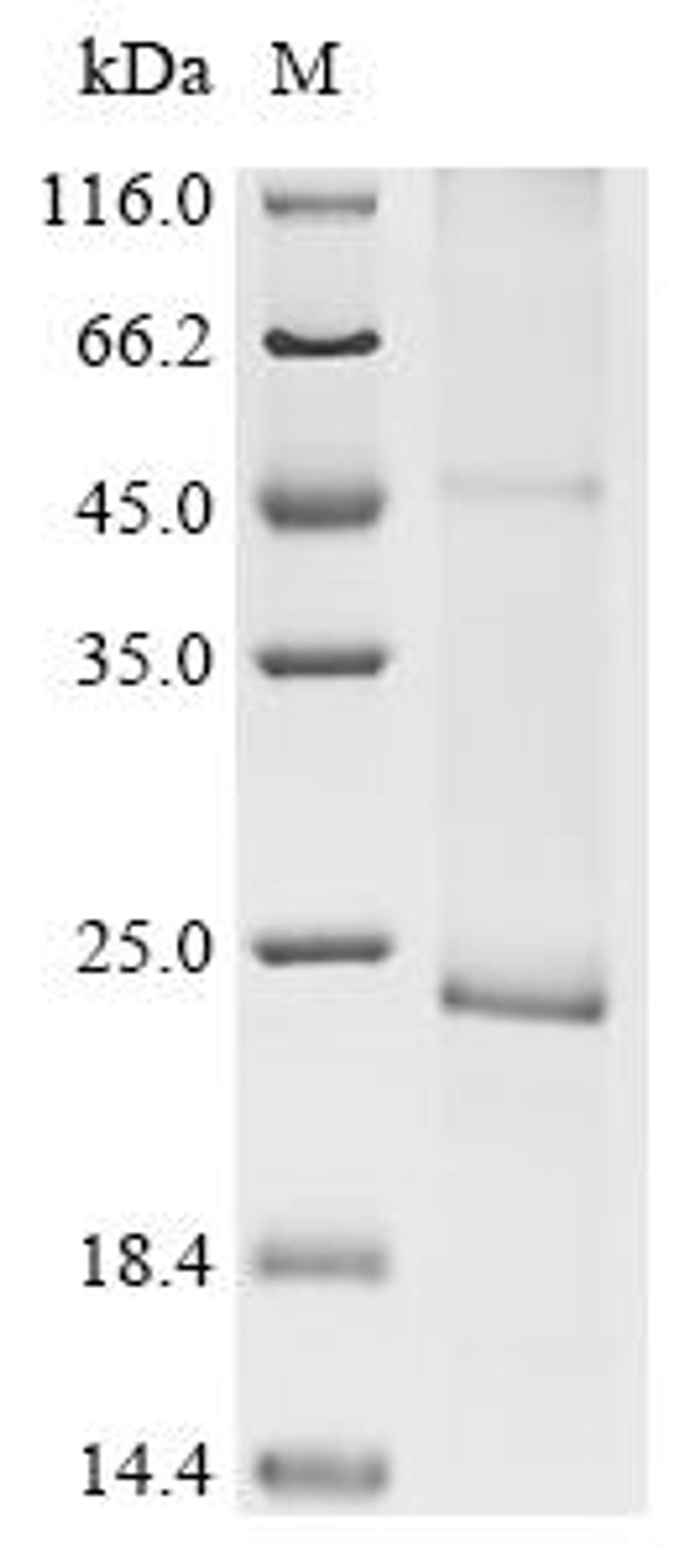 (Tris-Glycine gel) Discontinuous SDS-PAGE (reduced) with 5% enrichment gel and 15% separation gel.