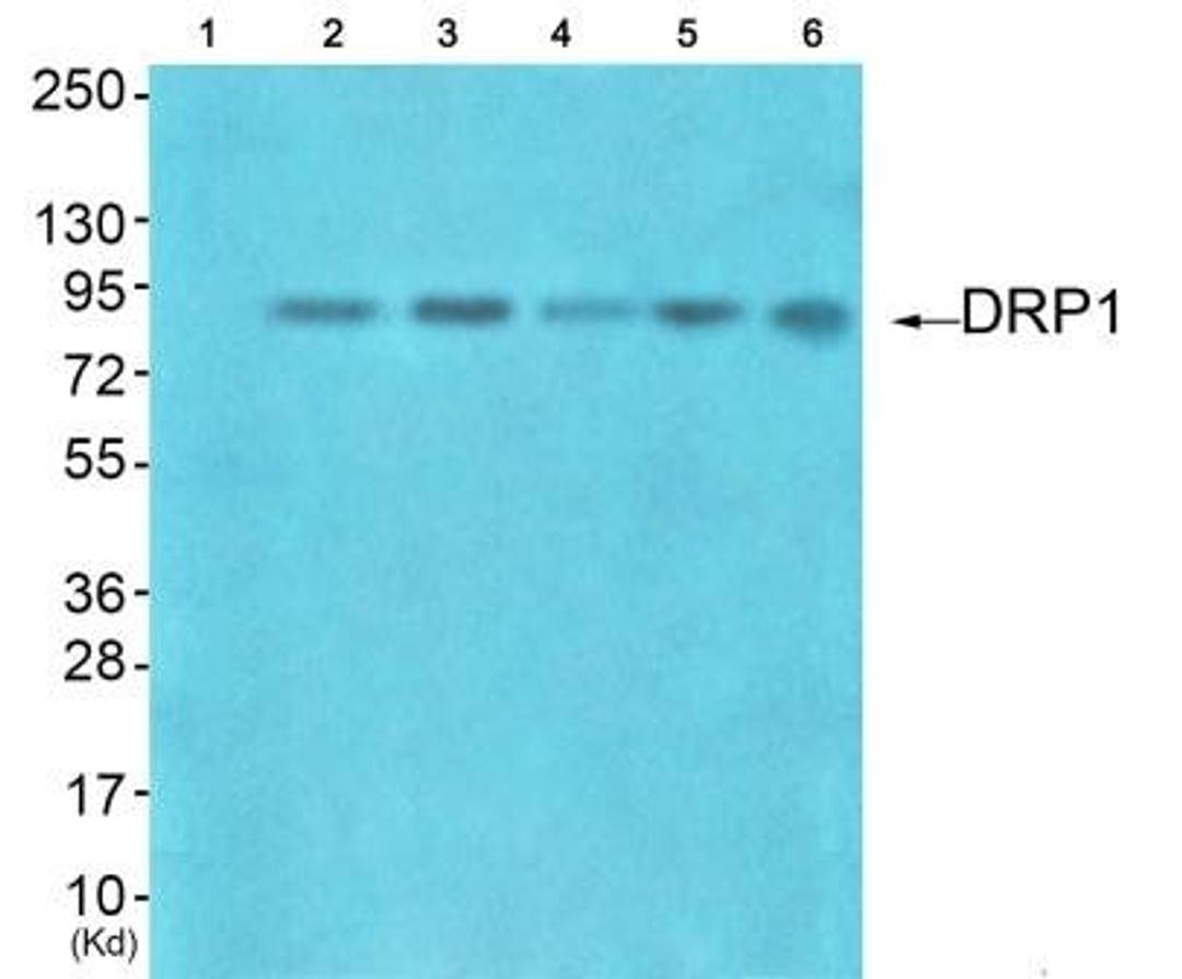 Western blot analysis of extracts from HuvEc cells (Lane 2), HepG2 cells (Lane 3), colo cells (Lane 4), 293 cells (Lane 5) and JK cells (Lane 6), using DRP1 (orb127443) Antibody. The lane on the left is treated with synthesized peptide.