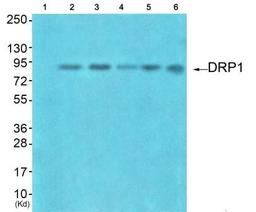 Western blot analysis of extracts from HuvEc cells (Lane 2), HepG2 cells (Lane 3), colo cells (Lane 4), 293 cells (Lane 5) and JK cells (Lane 6), using DRP1 (orb127443) Antibody. The lane on the left is treated with synthesized peptide.