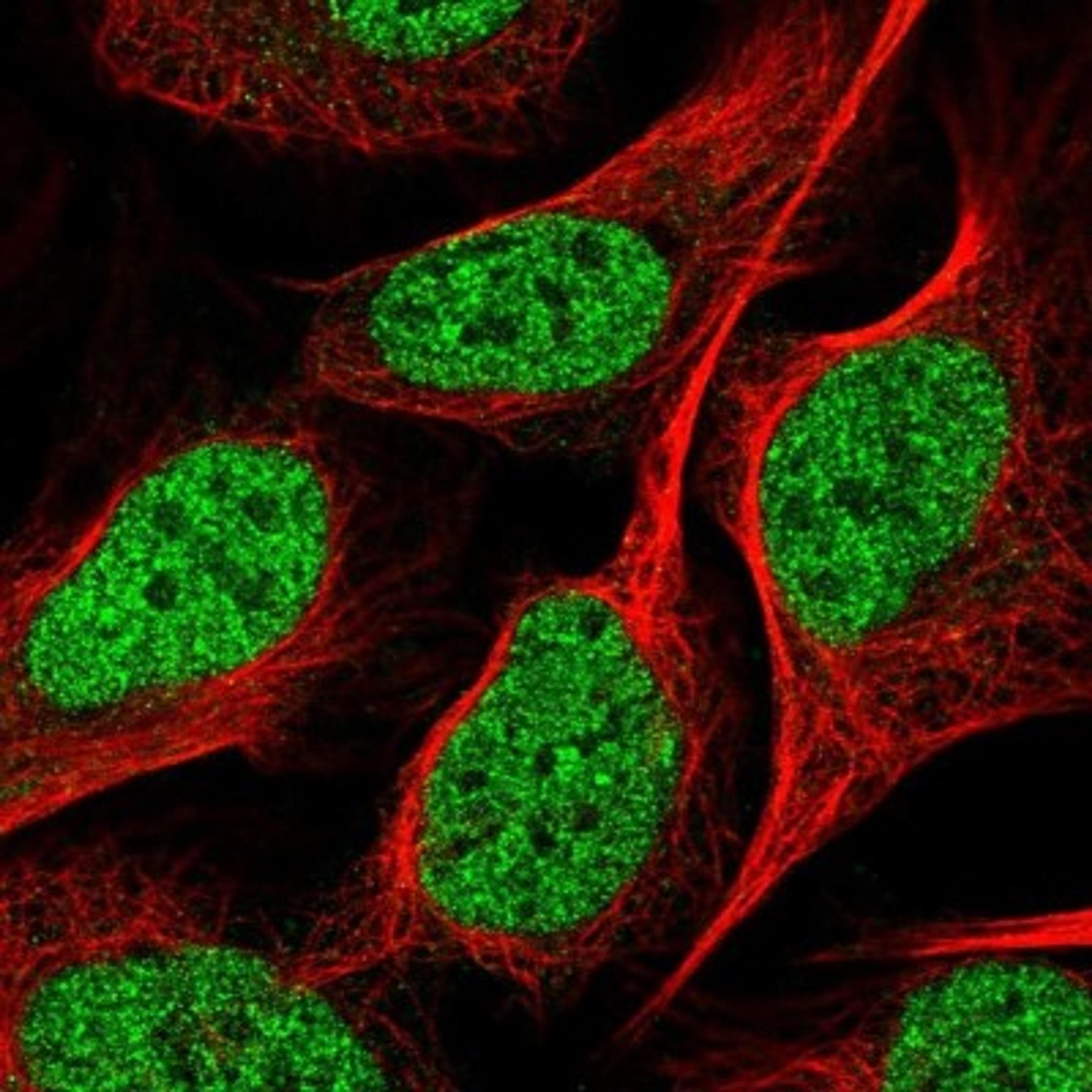 Immunocytochemistry/Immunofluorescence: NSMCE4A Antibody [NBP1-90789] - Staining of human cell line U-2 OS shows positivity in nucleus but not nucleoli & cytoplasm.