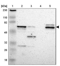 Western Blot: CRMP2 Antibody [NBP1-85448] - Lane 1: Marker [kDa] 230, 110, 82, 49, 32, 26, 18<br/>Lane 2: Human cell line RT-4<br/>Lane 3: Human cell line U-251MG sp<br/>Lane 4: Human plasma (IgG/HSA depleted)<br/>Lane 5: Human liver tissue