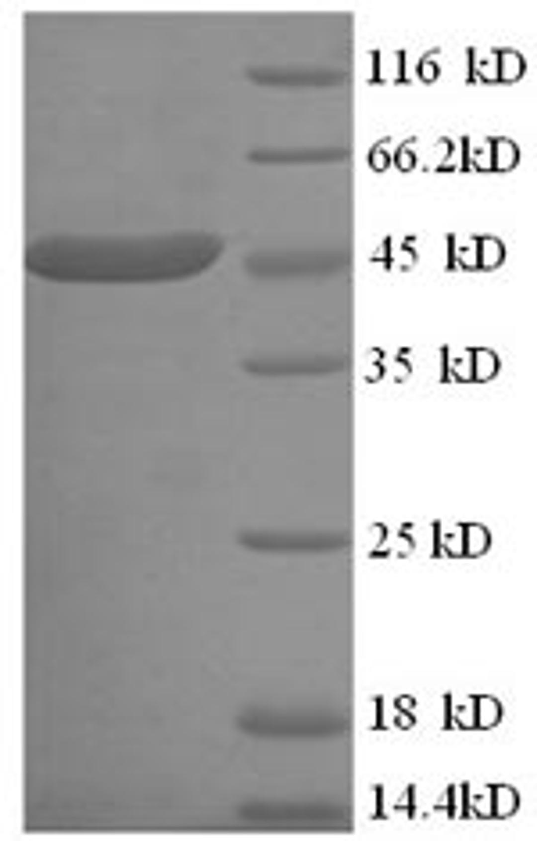 (Tris-Glycine gel) Discontinuous SDS-PAGE (reduced) with 5% enrichment gel and 15% separation gel.