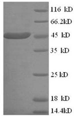 (Tris-Glycine gel) Discontinuous SDS-PAGE (reduced) with 5% enrichment gel and 15% separation gel.