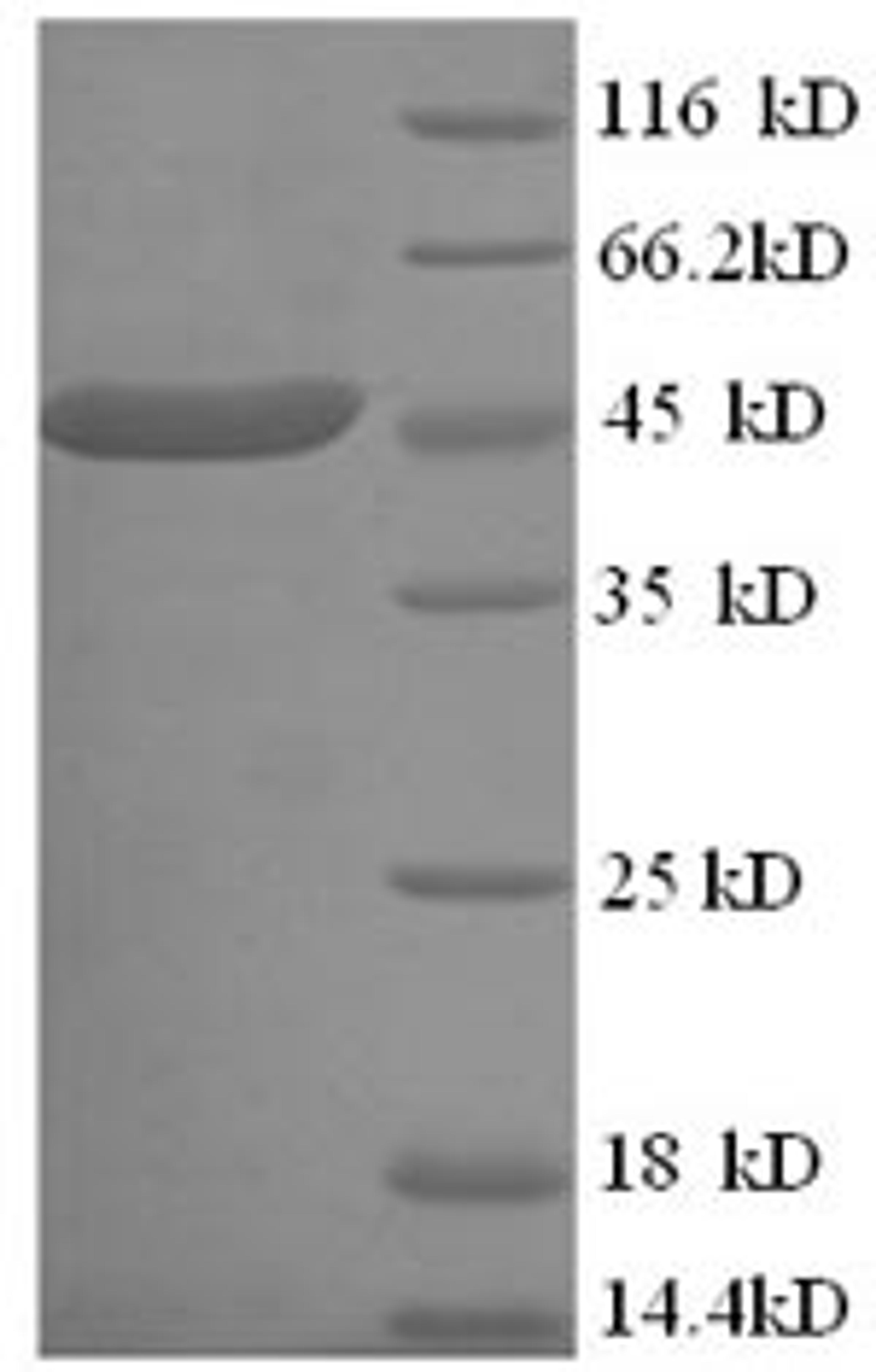 (Tris-Glycine gel) Discontinuous SDS-PAGE (reduced) with 5% enrichment gel and 15% separation gel.