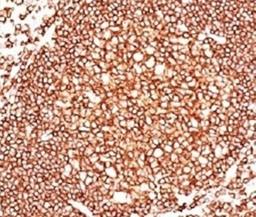 IHC: human tonsil stained with CD45 antibody