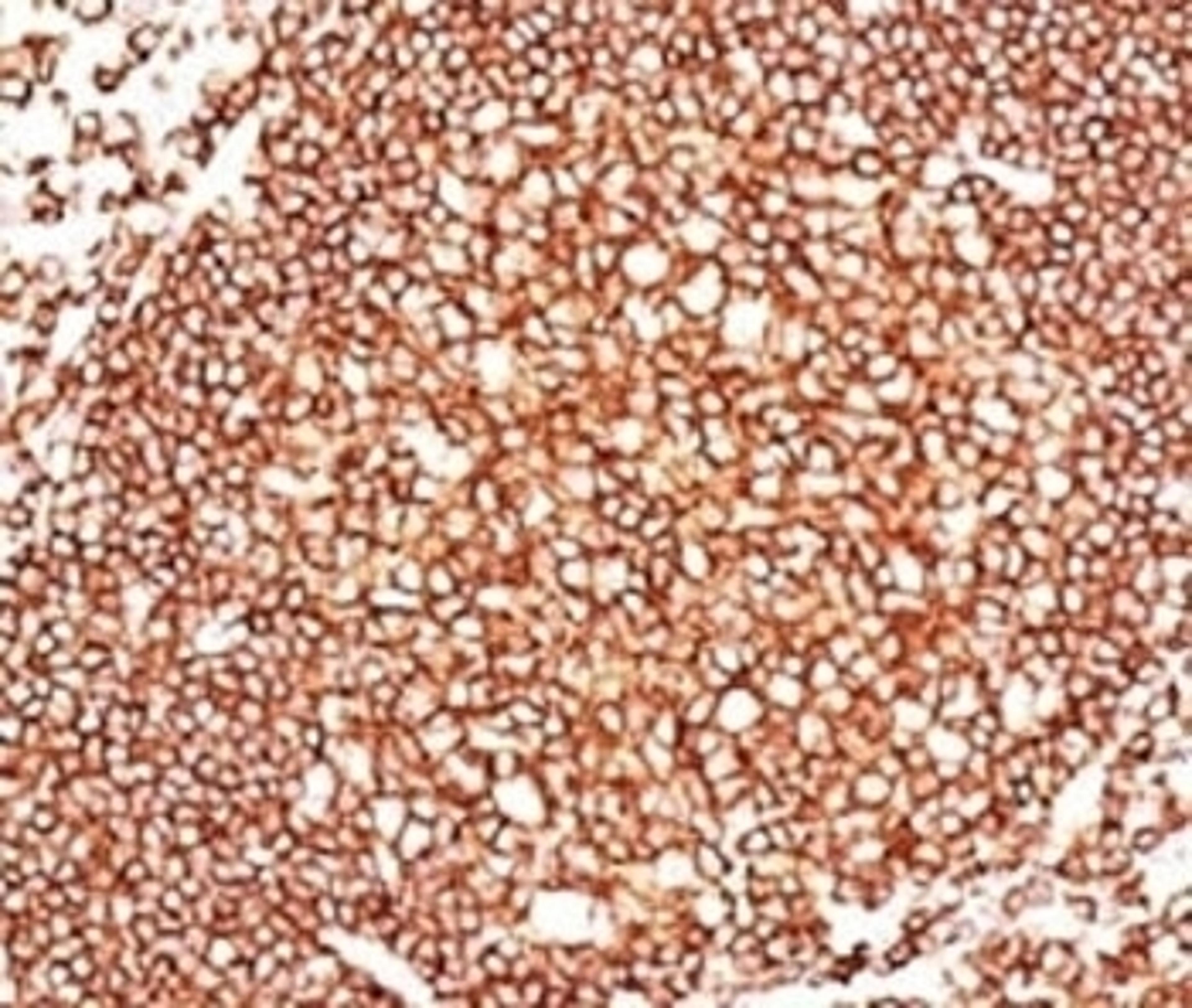 IHC: human tonsil stained with CD45 antibody