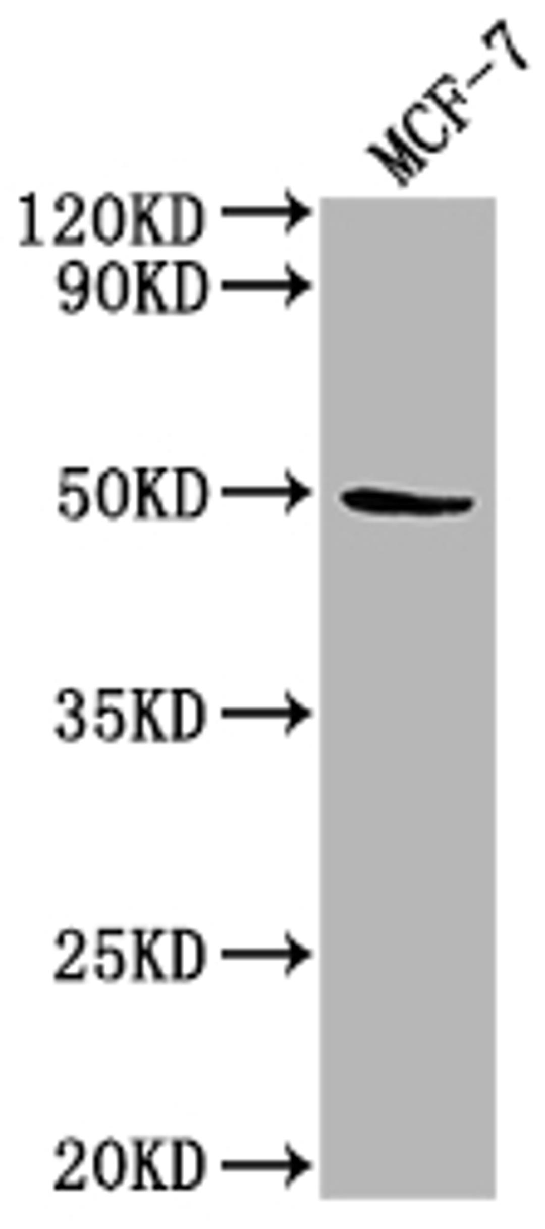 Western Blot. Positive WB detected in: MCF-7 whole cell lysate. All lanes: KLK11 antibody at 1:2000. Secondary. Goat polyclonal to rabbit IgG at 1/50000 dilution. Predicted band size: 32, 28, 34, 31 kDa. Observed band size: 50 kDa. 