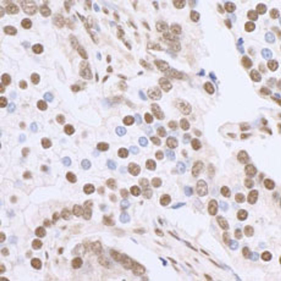 Detection of human SP1 by immunohistochemistry.