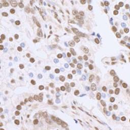 Detection of human SP1 by immunohistochemistry.