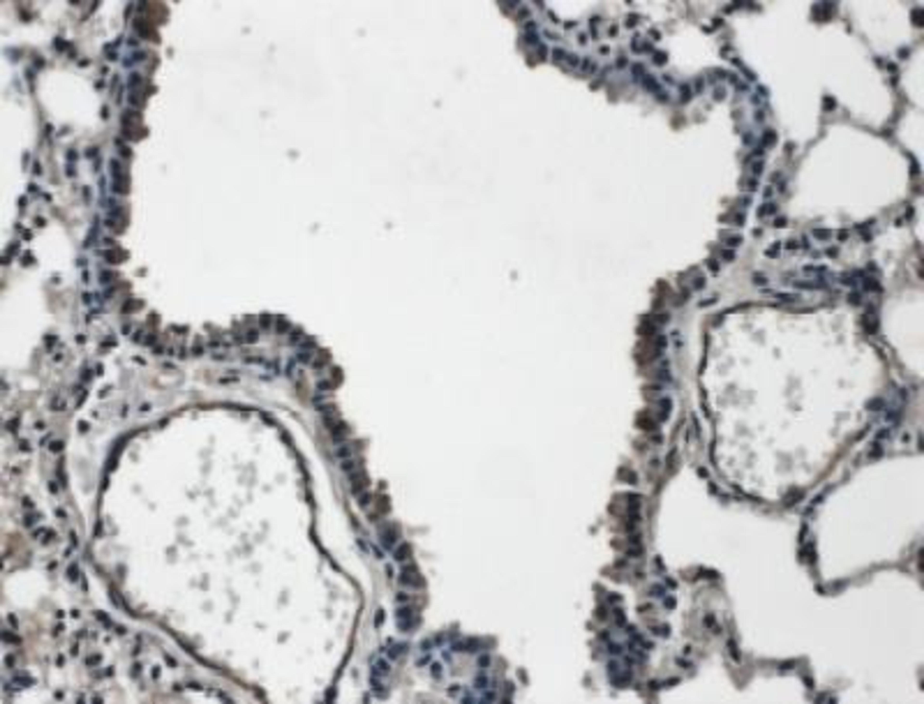 Immunohistochemistry: VEGF-C Antibody [NB110-61022] - VEGFC Antibody [NB110-61022] - 4% PFA fixed and paraffin embedded mouse Lung tissue section was subjected to IHC staining of mouse VEGF-C.