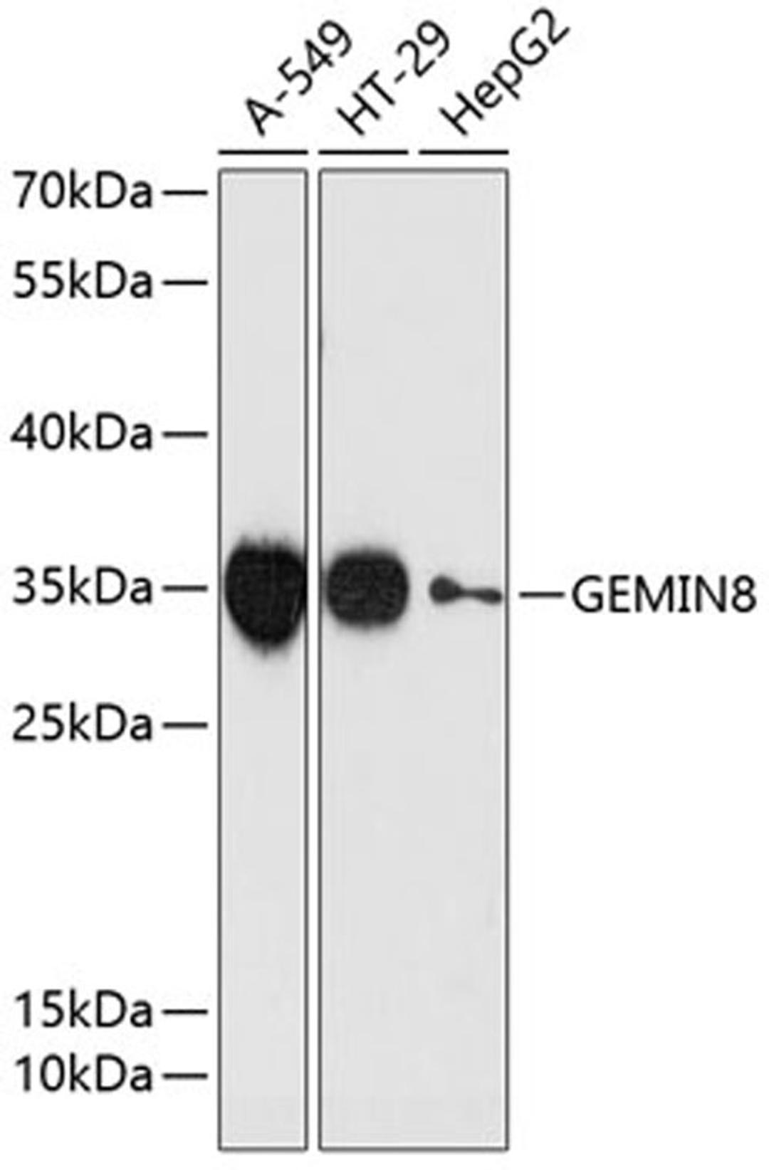 Western blot - GEMIN8 antibody (A13708)