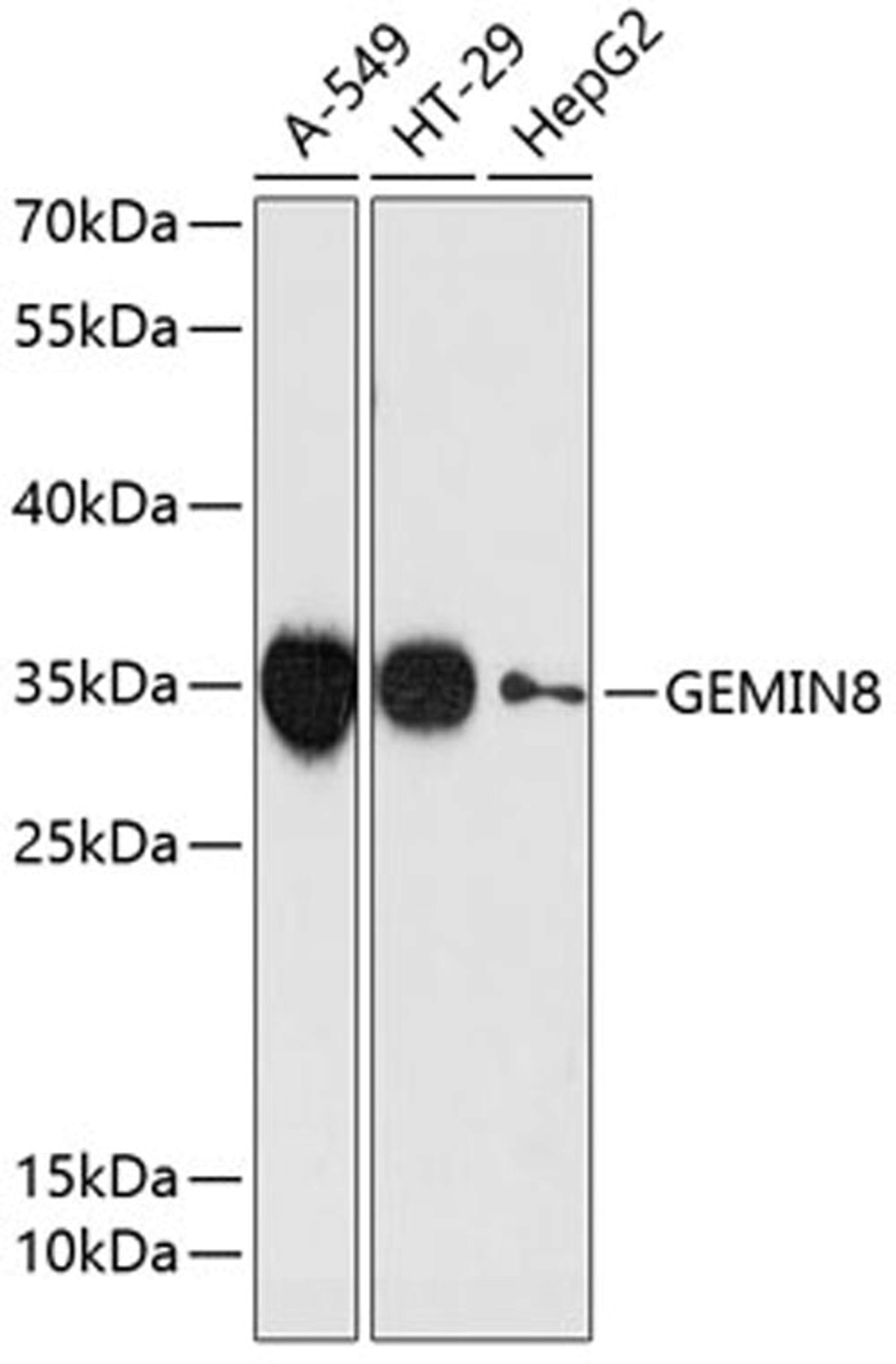 Western blot - GEMIN8 antibody (A13708)