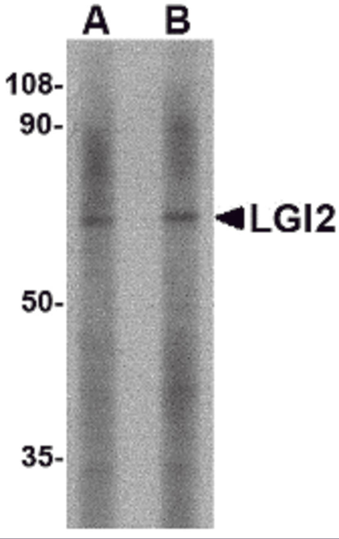 Western blot analysis of LGI2 in mouse liver tissue lysate with LGI2 antibody at (A) 1 and (B) 2 &#956;g/mL.