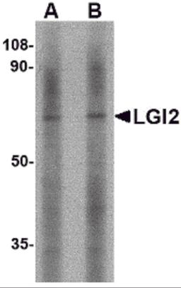 Western blot analysis of LGI2 in mouse liver tissue lysate with LGI2 antibody at (A) 1 and (B) 2 &#956;g/mL.