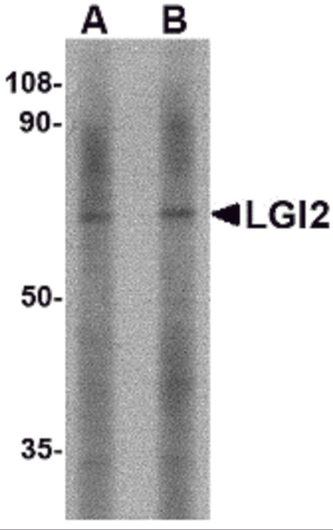 Western blot analysis of LGI2 in mouse liver tissue lysate with LGI2 antibody at (A) 1 and (B) 2 μg/mL.