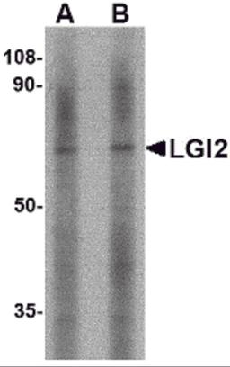 Western blot analysis of LGI2 in mouse liver tissue lysate with LGI2 antibody at (A) 1 and (B) 2 μg/mL.