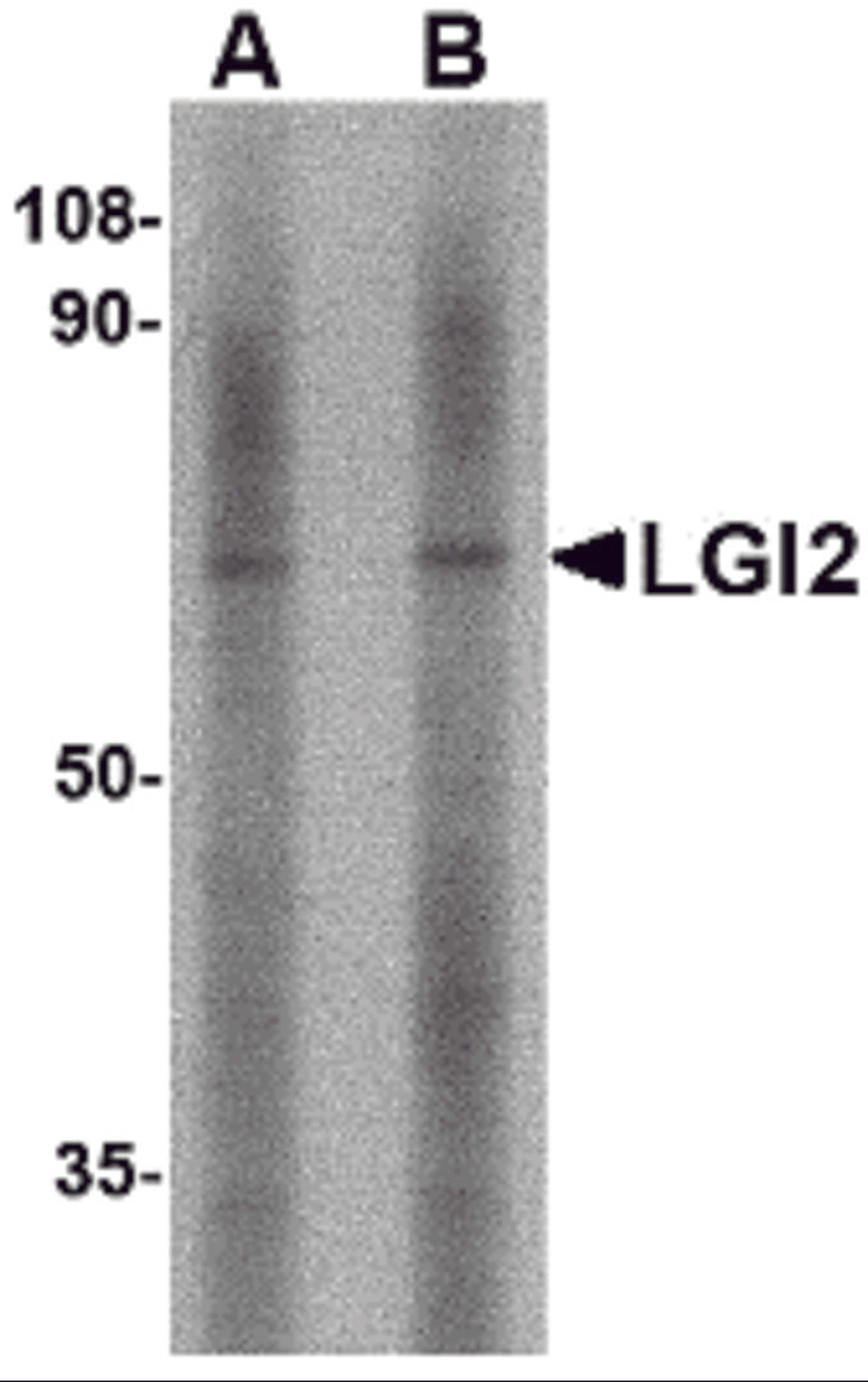 Western blot analysis of LGI2 in mouse liver tissue lysate with LGI2 antibody at (A) 1 and (B) 2 μg/mL.