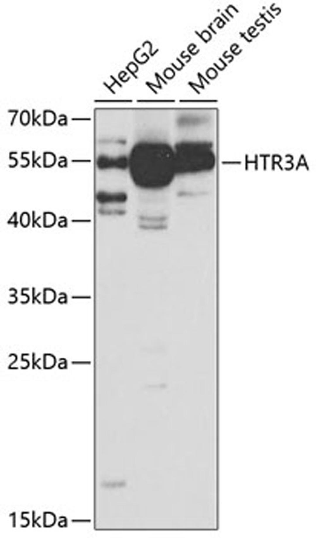 Western blot - HTR3A antibody (A5647)